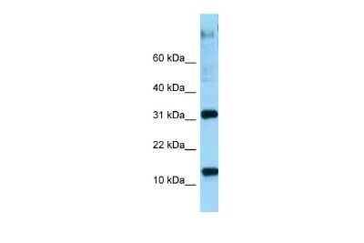 Western Blot: RPL22 Antibody [NBP2-86783]