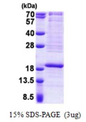 SDS-PAGE: Recombinant Human RPL22 His Protein [NBP2-23419]