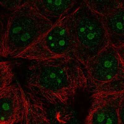 Immunocytochemistry/ Immunofluorescence: RPL22L1 Antibody [NBP2-68680]