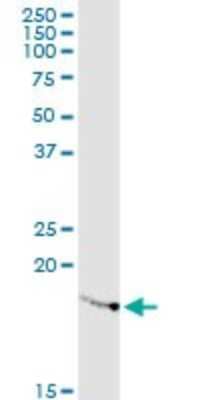 Western Blot: RPL23A Antibody (3E11) [H00006147-M10]