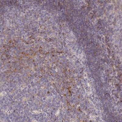 Immunohistochemistry-Paraffin: RPL23A Antibody [NBP2-13253]