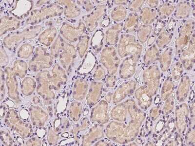 Immunohistochemistry-Paraffin: RPL23A Antibody [NBP2-97961]