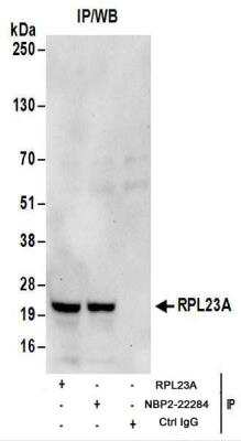 Immunoprecipitation: RPL23A Antibody [NBP2-22284]