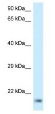 Western Blot: RPL23A Antibody [NBP1-79918]