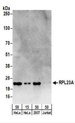 Western Blot: RPL23A Antibody [NBP2-22284]