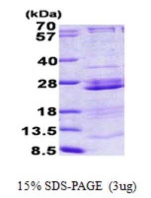 SDS-PAGE: Recombinant Human RPL23A His Protein [NBP2-23420]