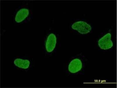 Immunocytochemistry/ Immunofluorescence: RPL24/RLP24 Antibody (2A10-1E5) [H00051187-M01]