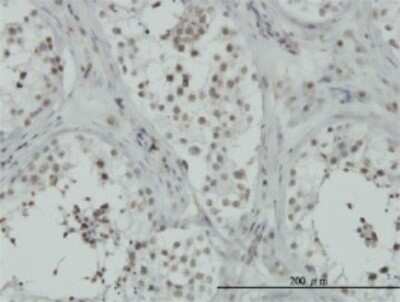 Immunohistochemistry-Paraffin: RPL24/RLP24 Antibody (2A10-1E5) [H00051187-M01]