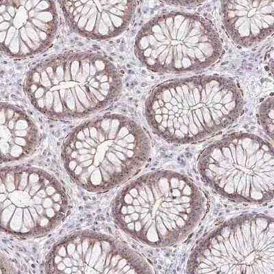Immunohistochemistry-Paraffin: RPL24/RLP24 Antibody [NBP2-38971]