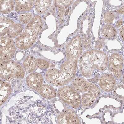 Immunohistochemistry-Paraffin: RPL24/RLP24 Antibody [NBP2-38971]