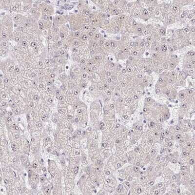 Immunohistochemistry-Paraffin: RPL24/RLP24 Antibody [NBP2-38971]