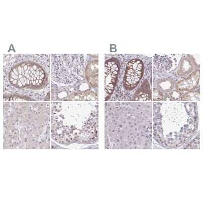 Immunohistochemistry-Paraffin: RPL24/RLP24 Antibody [NBP2-38971]