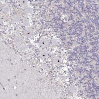Immunohistochemistry-Paraffin: RPL24/RLP24 Antibody [NBP2-38992]