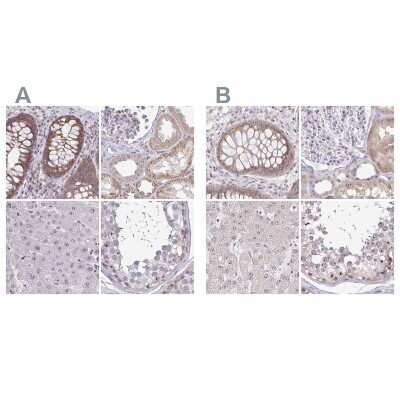 Immunohistochemistry-Paraffin: RPL24/RLP24 Antibody [NBP2-38992]