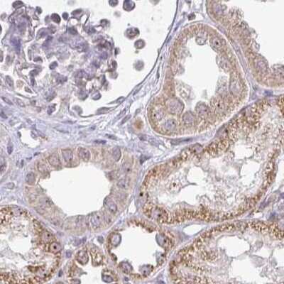 Immunohistochemistry-Paraffin: RPL24/RLP24 Antibody [NBP2-38992]