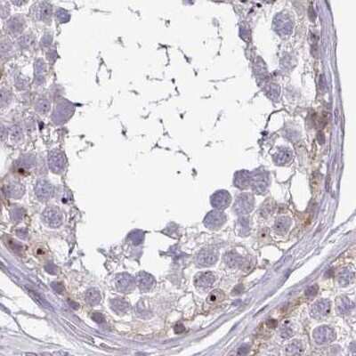 Immunohistochemistry-Paraffin: RPL24/RLP24 Antibody [NBP2-38992]