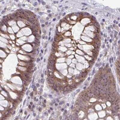 Immunohistochemistry-Paraffin: RPL24/RLP24 Antibody [NBP2-38992]