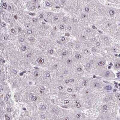Immunohistochemistry-Paraffin: RPL24/RLP24 Antibody [NBP2-38992]