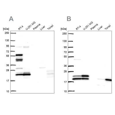 Western Blot: RPL24/RLP24 Antibody [NBP2-38971]