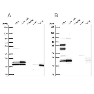 Western Blot: RPL24/RLP24 Antibody [NBP2-38992]