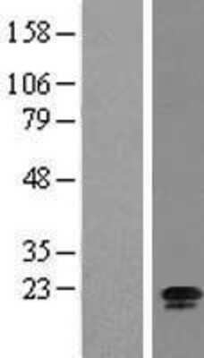 Western Blot: RPL24/RLP24 Overexpression Lysate [NBL1-08198]