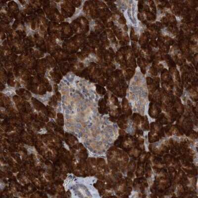 Immunohistochemistry-Paraffin: Ribosomal protein L26 Antibody [NBP1-80812]