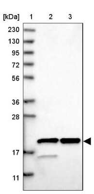 Western Blot: Ribosomal protein L26 Antibody [NBP1-80812]