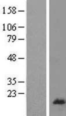 Western Blot: RPL26L1 Overexpression Lysate [NBL1-15518]