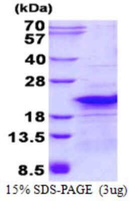 SDS-PAGE: Recombinant Human RPL26L1 His Protein [NBP2-23422]