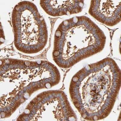 Immunohistochemistry-Paraffin: RPL27 Antibody [NBP1-82856]