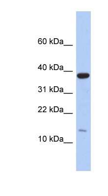 Western Blot: RPL27 Antibody [NBP1-54629]