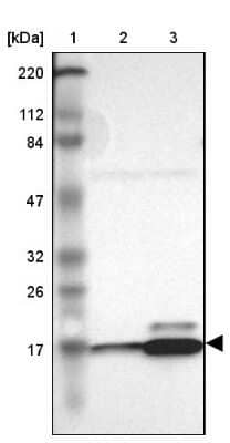 Western Blot: RPL27 Antibody [NBP1-82856]