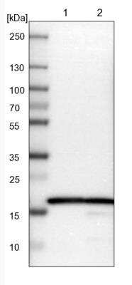 Western Blot: RPL27 Antibody [NBP1-82856]