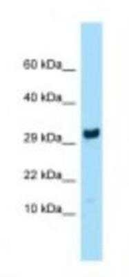 Western Blot: RPL27 Antibody [NBP1-98580]