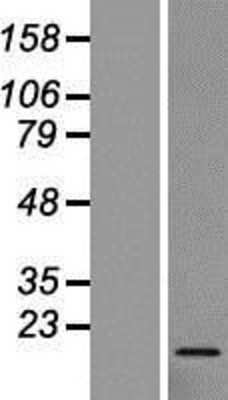 Western Blot: RPL27 Overexpression Lysate [NBL1-15519]