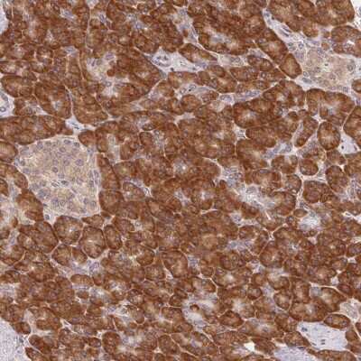 Immunohistochemistry: RPL27A Antibody [NBP2-38025]
