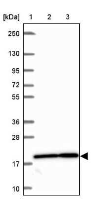 Western Blot: RPL27A Antibody [NBP2-38025]