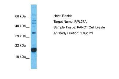 Western Blot: RPL27A Antibody [NBP2-85658]