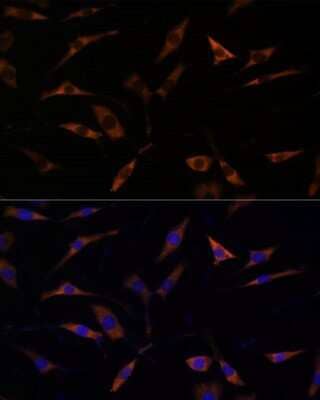 Immunocytochemistry/ Immunofluorescence: RPL28 Antibody - Azide and BSA Free [NBP2-93881]