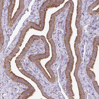 Immunohistochemistry-Paraffin: RPL28 Antibody [NBP2-13254]