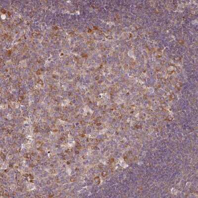 Immunohistochemistry-Paraffin: RPL28 Antibody [NBP2-13254]