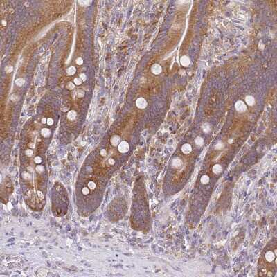 Immunohistochemistry-Paraffin: RPL28 Antibody [NBP2-13254]