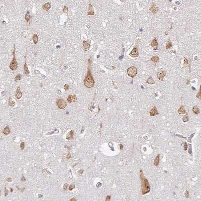 Immunohistochemistry-Paraffin: RPL28 Antibody [NBP2-13254]