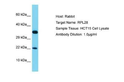 Western Blot: RPL28 Antibody [NBP2-83467]