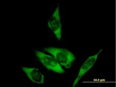 Immunocytochemistry/ Immunofluorescence: RPL29 Antibody [H00006159-B01P]