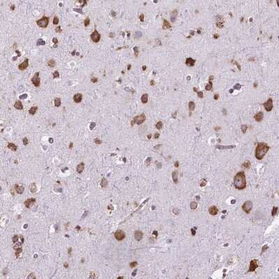 Immunohistochemistry-Paraffin: RPL29 Antibody [NBP2-49581]