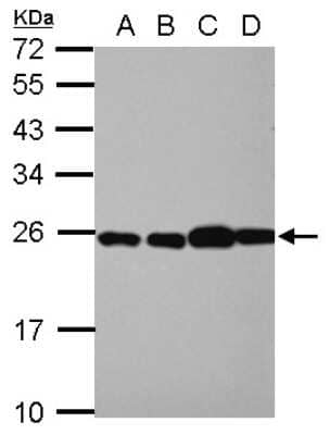 Western Blot: RPL29 Antibody [NBP2-15103]