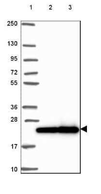 Western Blot: RPL29 Antibody [NBP2-49581]