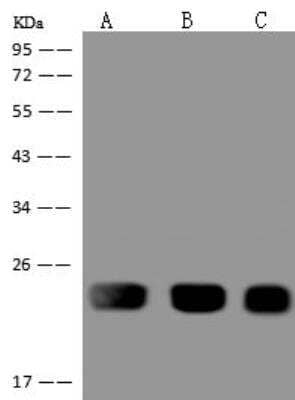 Western Blot: RPL29 Antibody [NBP3-12600]