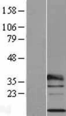 Western Blot: RPL29 Overexpression Lysate [NBP2-04184]